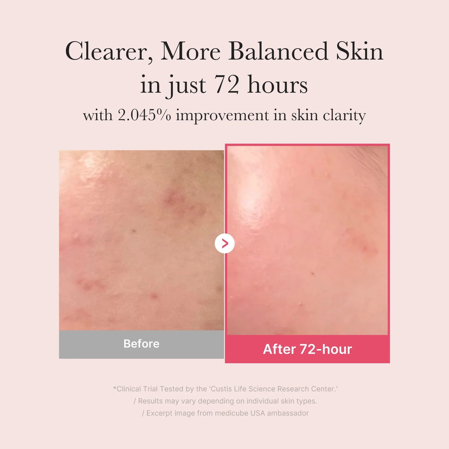 medicube TXA+Niacinamide 15% Glow Facial Serum for After Spot Care | All-in-One Daily Korean Skincare | Uneven Skin Tone, Texture, and Hydration Care | High-Potency Tranexamic Acid 5% | 1.01 fl.oz  2-Pack
