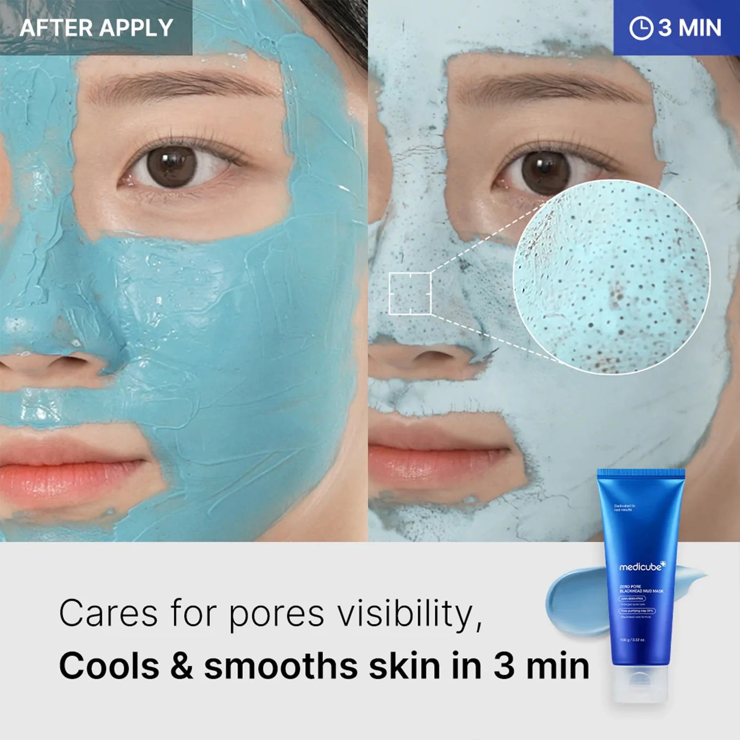 medicube Zero Pore Blackhead Mud Facial Mask - Skin Cooling & Pore Tightening - 3 Minute Quick Dry Formula with AHA, BHA, PHA, and Pore-Purifying Clay - Korean Mud Mask 3.52 oz 2-Pack